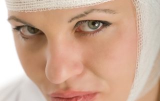 A woman with bandages after her plastic surgery.