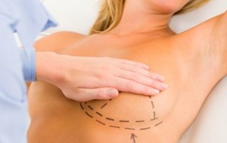 breast lift recovery is best achieved by rest.
