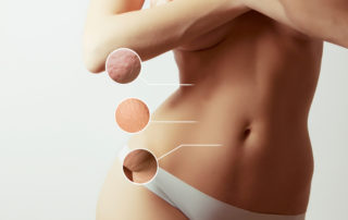 liposuction body contouring in mt juliet
