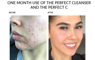 skin care lebanon tn the perfect derma peel chemical peels aesthetic skincare at the lett center