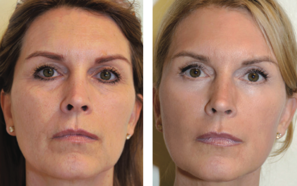 Skin Treatments in Mt Juliet & Lebanon TN | The Lett Center