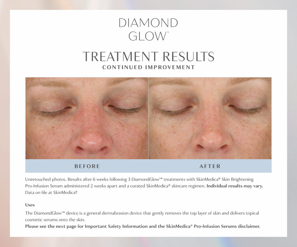 med spa best skin mt juliet diamond glow
