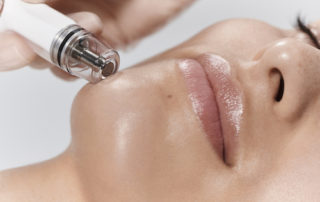 diamondglow facial treatment tennessee