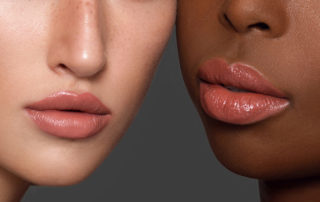 what you should know before getting lip injections