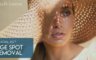 age spot removal treatments in mt juliet and lebanon tn