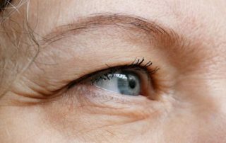 can contact lenses cause a droopy eyelid?
