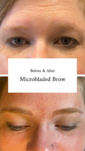 before and after microbladed brows