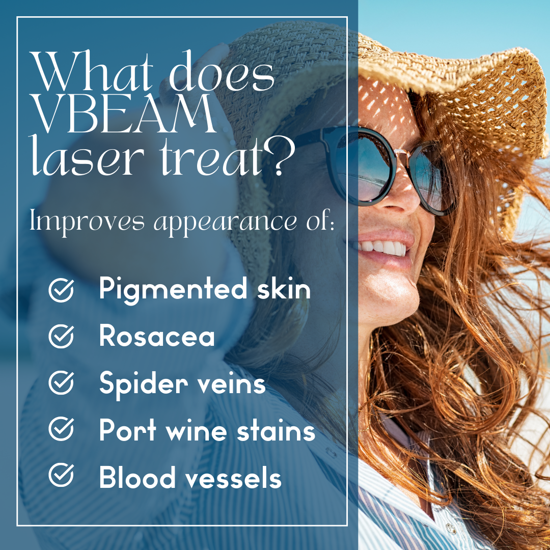 laser for rosacea in mt juliet and lebanon tn