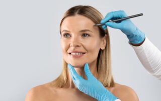 A woman getting marked for a facelift