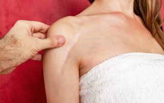 Surgeon examining a raised surgical scar on a woman's shoulder during a scar revision consultation